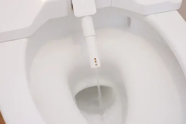 ウォシュレットのノズルのポタポタ水漏れは正常か故障か？